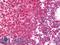 Serine/threonine-protein kinase PINK1, mitochondrial antibody, LS-B12148, Lifespan Biosciences, Immunohistochemistry paraffin image 