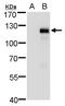 Myocardin Related Transcription Factor A antibody, PA5-35929, Invitrogen Antibodies, Western Blot image 