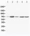 Succinate Dehydrogenase Complex Flavoprotein Subunit A antibody, PA1306, Boster Biological Technology, Western Blot image 
