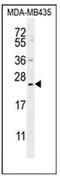 PH Domain Containing Endocytic Trafficking Adaptor 1 antibody, AP51519PU-N, Origene, Western Blot image 