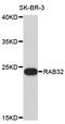 RAB32, Member RAS Oncogene Family antibody, STJ26685, St John