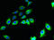 Cornichon Family AMPA Receptor Auxiliary Protein 2 antibody, LS-C399253, Lifespan Biosciences, Immunofluorescence image 