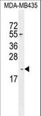 Killin, P53 Regulated DNA Replication Inhibitor antibody, LS-C165524, Lifespan Biosciences, Western Blot image 