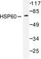 Heat Shock Protein Family D (Hsp60) Member 1 antibody, AP06174PU-N, Origene, Western Blot image 