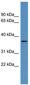 Olfactory Receptor Family 2 Subfamily H Member 2 antibody, TA342713, Origene, Western Blot image 