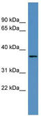 Olfactory receptor 2H2 antibody, TA342713, Origene, Western Blot image 