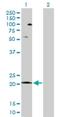 Cytochrome C Oxidase Subunit 5A antibody, H00009377-D01P, Novus Biologicals, Western Blot image 