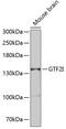 General Transcription Factor IIi antibody, GTX65927, GeneTex, Western Blot image 