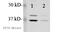 Heterogeneous Nuclear Ribonucleoprotein A1 antibody, ab5832, Abcam, Western Blot image 