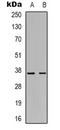 Growth hormone-inducible transmembrane protein antibody, LS-C368699, Lifespan Biosciences, Western Blot image 