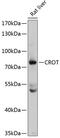 Peroxisomal carnitine O-octanoyltransferase antibody, A09812, Boster Biological Technology, Western Blot image 