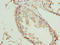 TRNA Methyltransferase 6 antibody, LS-C398242, Lifespan Biosciences, Immunohistochemistry paraffin image 