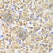 Serine hydroxymethyltransferase, mitochondrial antibody, A1215, ABclonal Technology, Immunohistochemistry paraffin image 