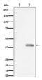 PDZ Binding Kinase antibody, P02623, Boster Biological Technology, Western Blot image 
