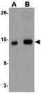 Interferon Induced Transmembrane Protein 1 antibody, GTX85181, GeneTex, Western Blot image 