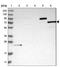 Kelch Like Family Member 40 antibody, NBP1-80723, Novus Biologicals, Western Blot image 