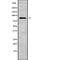 ERCC Excision Repair 2, TFIIH Core Complex Helicase Subunit antibody, abx215225, Abbexa, Western Blot image 