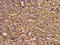 Lectin, Mannose Binding 1 antibody, LS-C674974, Lifespan Biosciences, Immunohistochemistry paraffin image 