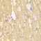 Tyrosine-protein kinase Tec antibody, orb154251, Biorbyt, Immunohistochemistry paraffin image 