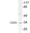 CD20 antibody, LS-C199791, Lifespan Biosciences, Western Blot image 