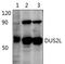 Dihydrouridine Synthase 2 antibody, PA5-75960, Invitrogen Antibodies, Western Blot image 