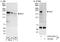 Rearranged L-Myc Fusion antibody, A303-207A, Bethyl Labs, Immunoprecipitation image 