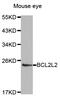BCL2L2-PABPN1 Readthrough antibody, LS-B14858, Lifespan Biosciences, Western Blot image 