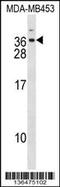 Distal-Less Homeobox 6 antibody, 58-638, ProSci, Western Blot image 