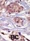 FYN Proto-Oncogene, Src Family Tyrosine Kinase antibody, abx033634, Abbexa, Immunohistochemistry paraffin image 