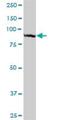 Tubulin Tyrosine Ligase Like 6 antibody, H00284076-B01P, Novus Biologicals, Western Blot image 