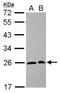 Secretion Associated Ras Related GTPase 1A antibody, NBP2-20261, Novus Biologicals, Western Blot image 