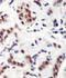 Signal Transducer And Activator Of Transcription 5A antibody, LS-C335807, Lifespan Biosciences, Immunohistochemistry paraffin image 