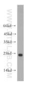NADH:Ubiquinone Oxidoreductase Complex Assembly Factor 2 antibody, 13891-1-AP, Proteintech Group, Western Blot image 