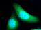 Zinc Finger Protein 215 antibody, 25502-1-AP, Proteintech Group, Immunofluorescence image 