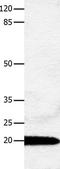 p21 antibody, TA323670, Origene, Western Blot image 