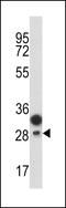 Protein C Receptor antibody, LS-C168523, Lifespan Biosciences, Western Blot image 