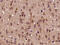 Biglycan antibody, GTX57229, GeneTex, Immunohistochemistry paraffin image 