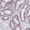 Histone Deacetylase 8 antibody, NBP2-14085, Novus Biologicals, Immunohistochemistry frozen image 