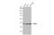 Mitogen-Activated Protein Kinase Kinase 3 antibody, GTX107529, GeneTex, Western Blot image 