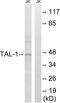 TAL BHLH Transcription Factor 1, Erythroid Differentiation Factor antibody, LS-C118375, Lifespan Biosciences, Western Blot image 