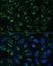 Electron Transfer Flavoprotein Subunit Beta antibody, 16-393, ProSci, Immunofluorescence image 