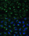 Electron transfer flavoprotein subunit beta antibody, 16-393, ProSci, Immunofluorescence image 