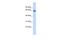 Zinc Finger Protein 74 antibody, A10234, Boster Biological Technology, Western Blot image 