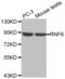 E3 ubiquitin-protein ligase RNF6 antibody, abx002371, Abbexa, Western Blot image 