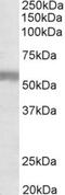 Natriuretic Peptide Receptor 3 antibody, NBP1-97777, Novus Biologicals, Western Blot image 