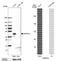 Retinoic acid-induced protein 3 antibody, NBP1-89743, Novus Biologicals, Western Blot image 