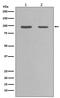 Heat Shock Protein 90 Alpha Family Class A Member 1 antibody, M01103-3, Boster Biological Technology, Western Blot image 