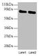 OTU Deubiquitinase, Ubiquitin Aldehyde Binding 1 antibody, CSB-PA03595A0Rb, Cusabio, Western Blot image 