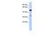 Phosphoinositide-3-Kinase Interacting Protein 1 antibody, GTX45899, GeneTex, Western Blot image 