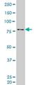 Protein Kinase C Delta antibody, H00005580-M06, Novus Biologicals, Western Blot image 